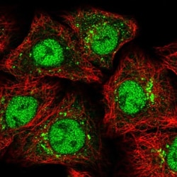 ZMIZ1/Zimp10 Antibody, Novus Biologicals:Antibodies:Primary Antibodies